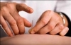 Châm cứu chữa yếu sinh lý