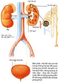 Bệnh sỏi tiết niệu