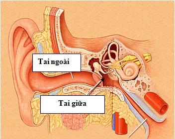 NHỌT TAI ĐAU LOÉT