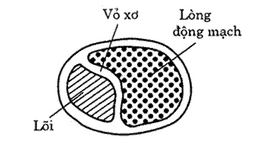 ĐỘNG MẠCH VÀNH XƠ CỨNG